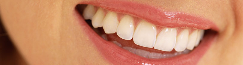 female smiling with white teeth