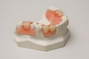 a mold of dentures