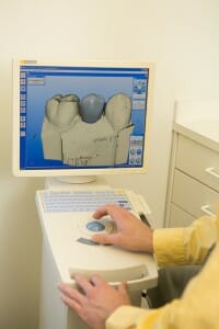 dentist at Fixari Family Dental using CEREC computer technology
